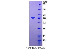 SDS-PAGE (SDS) image for Reelin (RELN) (AA 2086-2296) protein (His tag) (ABIN2126645)