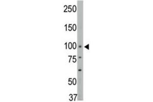 Western Blotting (WB) image for anti-Protein tyrosine Phosphatase, Non-Receptor Type 3 (PTPN3) antibody (ABIN3003754) (PTPN3 antibody)