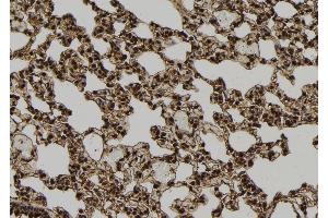 ABIN6277720 at 1/100 staining Rat lung tissue by IHC-P. (TXNIP antibody  (Internal Region))