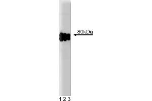 Western Blotting (WB) image for anti-Scavenger Receptor Class B, Member 1 (SCARB1) (AA 104-294) antibody (ABIN968231) (SCARB1 antibody  (AA 104-294))