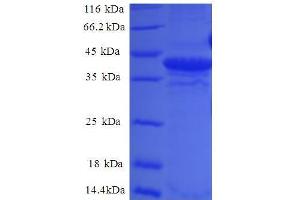 Small Nuclear Ribonucleoprotein D2 Polypeptide 16. (SNRPD2 Protein (AA 1-118, full length) (GST tag))