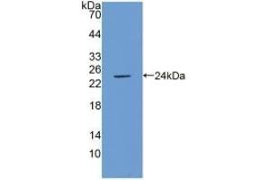 Detection of Recombinant ICAM1, Porcine using Polyclonal Antibody to Intercellular Adhesion Molecule 1 (ICAM1) (ICAM1 antibody  (AA 27-209))