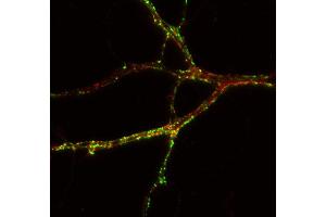 Indirect immunostaining of PFA fixed rat hippocampus neurons with anti-TNiK (dilution 1 : 500; red) and mouse anti-synapsin 1 (, dilution 1 : 500; green) (TNIK antibody  (AA 601-704))