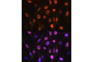 Immunofluorescence analysis of NIH-3T3 cells using B Rabbit mAb (ABIN7265377) at dilution of 1:100 (40x lens). (ANP32B antibody)