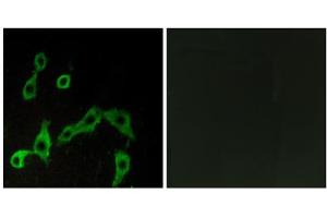 Immunofluorescence analysis of LOVO cells, using ADRA2A antibody.