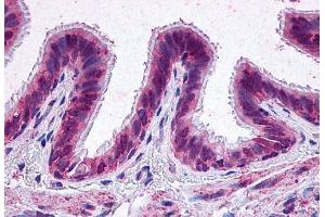 Anti-EP2 antibody  ABIN1048568 IHC staining of human lung.