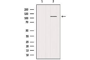 Western blot analysis of extracts from Mouse brain, using Androgen Receptor Antibody.