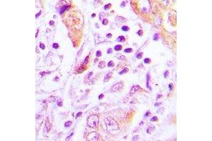 Immunohistochemistry (IHC) image for anti-TSC22 Domain Family, Member 3 (TSC22D3) antibody (ABIN7308446) (TSC22D3 antibody)