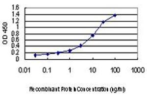 Detection limit for recombinant GST tagged FLJ20643 is approximately 0. (PIH1D1 antibody  (AA 1-290))