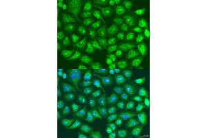 Immunofluorescence analysis of U2OS cells using SPICE1 antibody. (SPICE1 antibody  (AA 1-220))