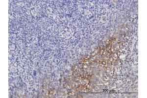 Immunostaining (ISt) image for anti-Serpin Peptidase Inhibitor, Clade G (C1 Inhibitor), Member 1 (SERPING1) (AA 1-500) antibody (ABIN513844)