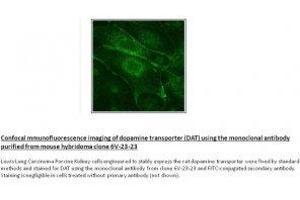 Image no. 1 for anti-Solute Carrier Family 6 (Neurotransmitter Transporter, Dopamine), Member 3 (SLC6A3) (N-Term) antibody (ABIN1169684) (SLC6A3 antibody  (N-Term))