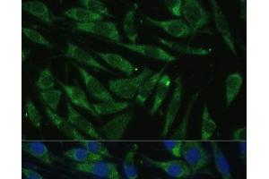 Immunofluorescence analysis of L929 cells using PITRM1 Polyclonal Antibody at dilution of 1:100 (40x lens).