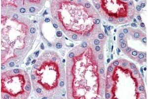 Human Kidney (formalin-fixed, paraffin-embedded) stained with ACE antibody ABIN337280 at 10 ug/ml followed by biotinylated anti-mouse IgG secondary antibody ABIN481714, alkaline phosphatase-streptavidin and chromogen. (Angiotensin I Converting Enzyme 1 antibody)
