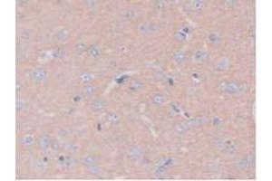 IHC-P analysis of Rat Brain Tissue, with DAB staining. (PTPRB antibody  (AA 1041-1310))