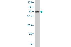 Western Blotting (WB) image for anti-Glycerol-3-Phosphate Dehydrogenase 1 (Soluble) (GPD1) (AA 1-349) antibody (ABIN561097)