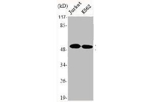 Western Blot analysis of Jurkat K562 cells using DR4 Polyclonal Antibody (TNFRSF1A antibody  (C-Term))