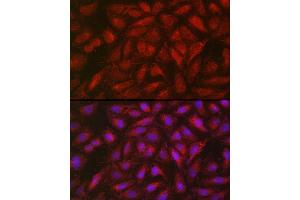 Immunofluorescence analysis of U2OS cells using SOCS3 Rabbit pAb (ABIN3015316, ABIN3015317, ABIN5663764 and ABIN6213984) at dilution of 1:50 (40x lens). (SOCS3 antibody  (C-Term))
