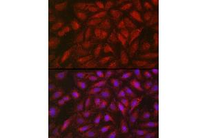 Immunofluorescence analysis of U2OS cells using SOCS3 Rabbit pAb (ABIN3015316, ABIN3015317, ABIN5663764 and ABIN6213984) at dilution of 1:50 (40x lens). (SOCS3 antibody  (C-Term))