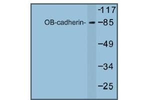Image no. 1 for anti-Cadherin 11 (CDH11) antibody (ABIN317681) (OB Cadherin antibody)