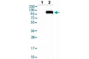 Western blot analysis of Lane 1: Negative control (vector only transfected HEK293T lysate), Lane 2: Over-expression lysate (Co-expressed with a C-terminal myc-DDK tag (~3. (Fibulin 1 antibody  (AA 266-402))