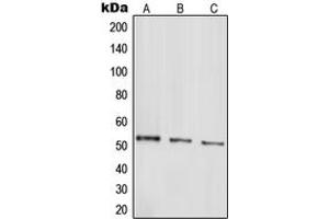 Western blot analysis of Parkin expression in HepG2 (A), SHSY5Y (B), SW480 (C) whole cell lysates. (Parkin antibody  (N-Term))