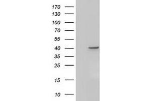 Western Blotting (WB) image for anti-Acetyl-CoA Acetyltransferase 2 (ACAT2) antibody (ABIN1496405) (ACAT2 antibody)
