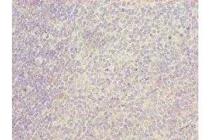 Immunohistochemistry of paraffin-embedded human tonsil tissue using ABIN7156460 at dilution of 1:100 (ITGAL antibody  (AA 201-500))