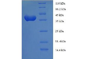 SDS-PAGE (SDS) image for Anaphase Promoting Complex Subunit 15 (ANAPC15) (AA 1-121), (full length) protein (GST tag) (ABIN5709159) (ANAPC15 Protein (AA 1-121, full length) (GST tag))