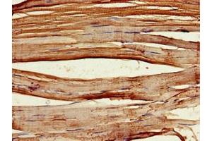 Immunohistochemistry of paraffin-embedded human skeletal muscle tissue using ABIN7162710 at dilution of 1:100 (PCID2 antibody  (AA 2-250))