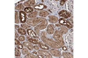 Immunohistochemical staining of human kidney with BHLHE23 polyclonal antibody  shows strong cytoplasmic and nuclear positivity in cells in tubules at 1:10-1:20 dilution.
