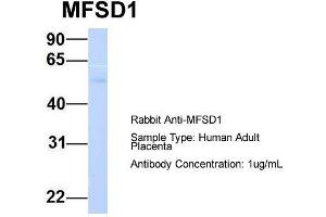 Host:  Rabbit  Target Name:  MFSD1  Sample Type:  Human Adult Placenta  Antibody Dilution:  1. (MFSD1 antibody  (Middle Region))