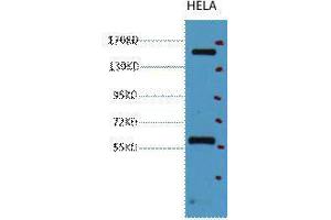 Western Blot (WB) analysis of HeLa, diluted at 1:2000. (CD45 antibody)