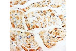 IHC-P: PMVK antibody testing of rat skeletal muscle tissue (PMVK antibody  (Middle Region))