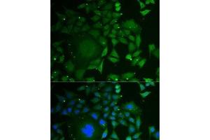 Immunofluorescence analysis of U2OS cells using C1D Polyclonal Antibody
