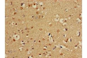 Immunohistochemistry of paraffin-embedded human brain tissue using ABIN7146829 at dilution of 1:100