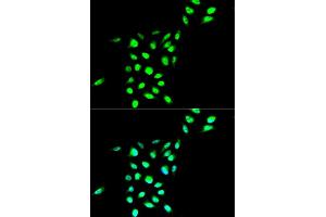 Immunofluorescence analysis of A549 cell using VCP antibody. (VCP antibody)