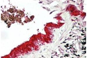Immunohistochemical staining (Formalin-fixed paraffin-embedded sections) of human lung with MXI1 polyclonal antibody  at 4-8 ug/mL working concentration. (MXI1 antibody  (Internal Region))