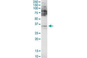 SPDEF polyclonal antibody (A01). (SPDEF/PSE antibody  (AA 1-335))