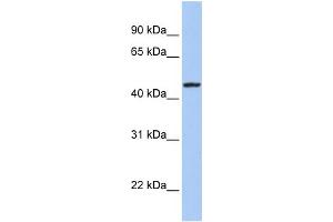 WB Suggested Anti-ROM1 Antibody Titration:  0. (ROM1 antibody  (Middle Region))