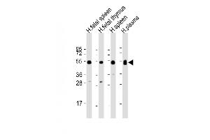 All lanes : Anti-IGHG1 Antibody (Center) at 1:2000 dilution Lane 1: human fetal spleen lysate Lane 2: human fetal thymus lysate Lane 3: human spleen lysate Lane 4: human plasma lysate Lysates/proteins at 20 μg per lane. (IGHG1 antibody  (AA 74-102))