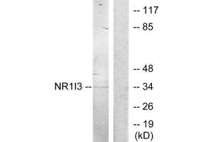 Western Blotting (WB) image for anti-Nuclear Receptor Subfamily 1, Group I, Member 3 (NR1I3) (Internal Region) antibody (ABIN1849606)