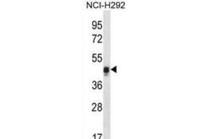 Western Blotting (WB) image for anti-Calumenin (CALU) antibody (ABIN2996650)