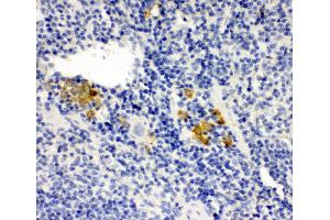 Anti-Leupaxin antibody, IHC(P) IHC(P): Mouse Spleen Tissue (Leupaxin antibody  (N-Term))