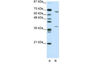 WB Suggested Antibody Titration:  0. (GRHL3 antibody  (C-Term))