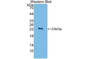 Detection of Recombinant PGLYRP1, Mouse using Polyclonal Antibody to Peptidoglycan Recognition Protein 1 (PGLYRP1) (PGLYRP1 antibody  (AA 19-182))