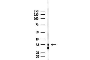 anti-Olfactory Receptor, Family 4, Subfamily C, Member 45 (OR4C45) (Internal Region) antibody