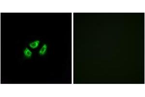 Immunofluorescence analysis of A549 cells, using SCN7A Antibody. (SCN7A antibody  (AA 771-820))
