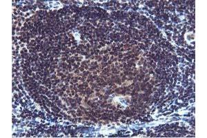 Image no. 1 for anti-Cystatin SA (CST2) antibody (ABIN1497759) (CST2 antibody)