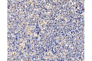 IHC analysis of PMPCA/INPP5 using anti-PMPCA/INPP5 antibody (ABIN7602722). (PMPCA antibody  (AA 99-525))